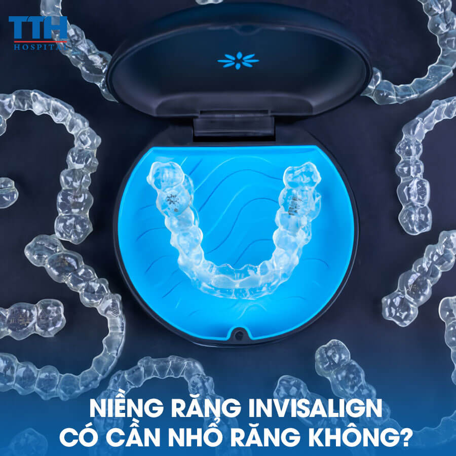 Niềng Răng Invisalign Có Cần Nhổ Răng Không?