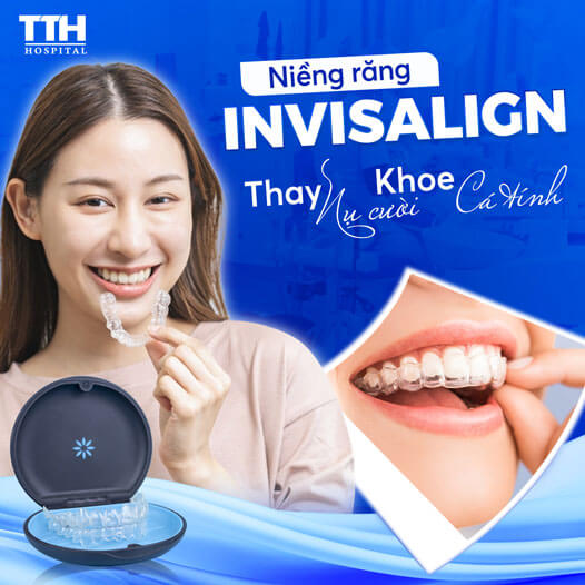 Niềng răng Invisalign