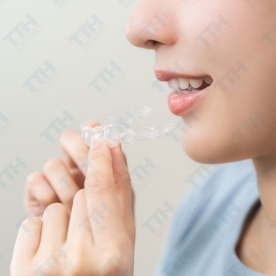Niềng răng trong suốt có phải nhổ răng không? Chuyên gia giải đáp chi tiết