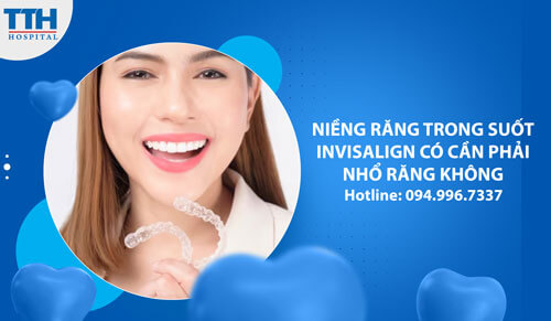 Niềng răng trong suốt INVISALIGN có cần phải nhổ răng không