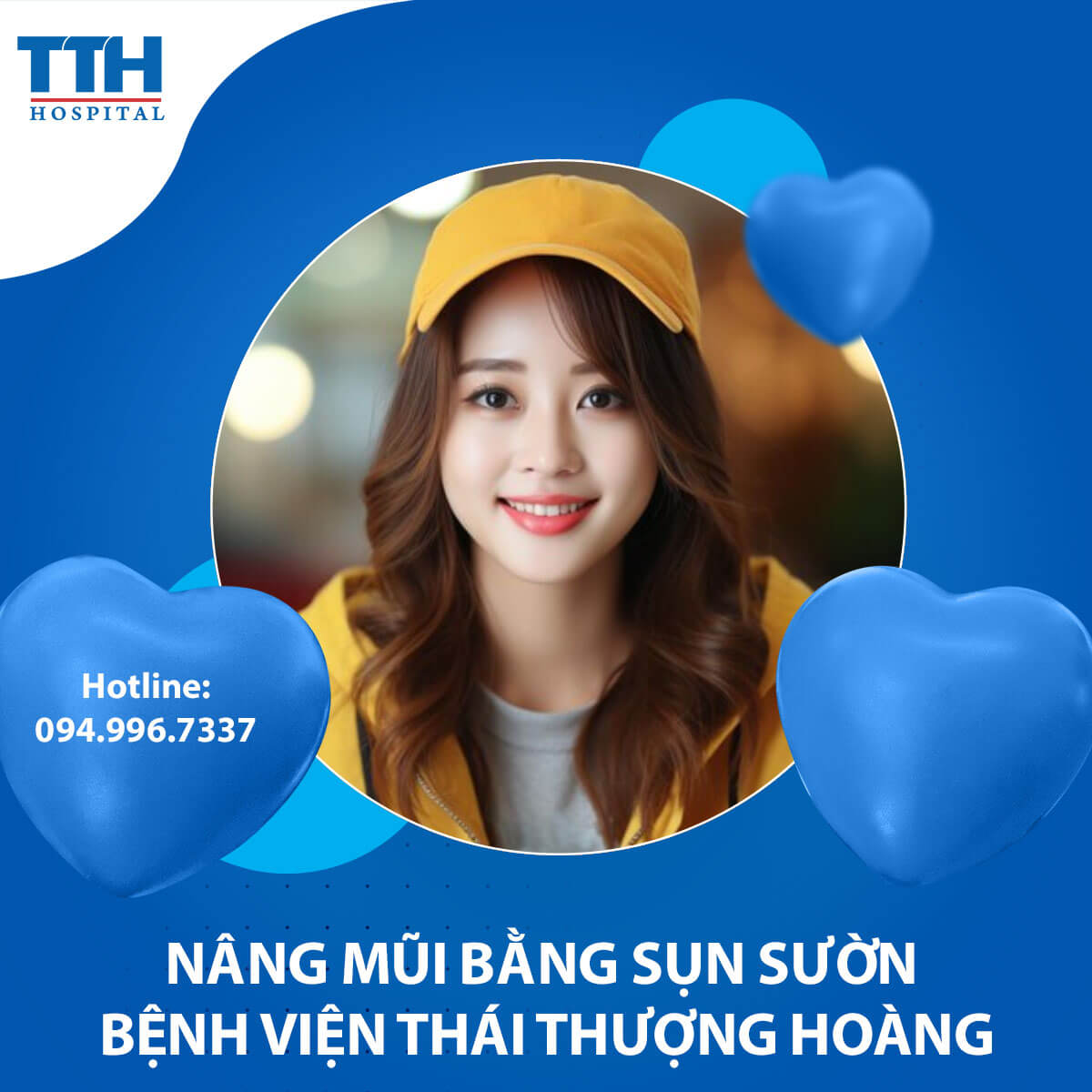 Phương Pháp Nâng Mũi Bằng Sụn Sườn Tại Vinh, Nghệ An