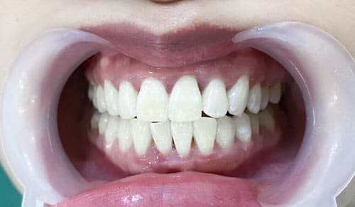 Răng Sáng, Cười Duyên - Tự Tin Đón Tết Cùng Bệnh Viện Thái Thượng Hoàng