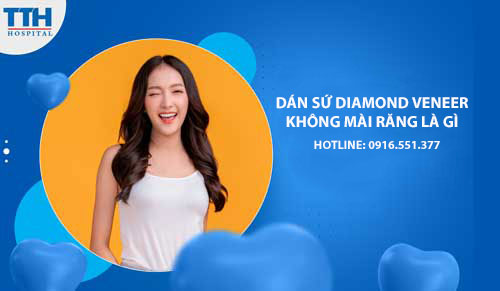 DIAMOND VENEER ĐỘT PHÁ CÔNG NGHỆ DÁN SỨ KHÔNG MÀI RĂNG - KHÔNG XÂM LẤN