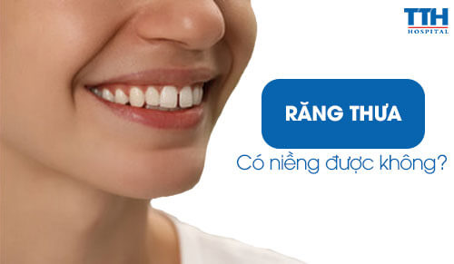 Răng thưa có niềng được không?