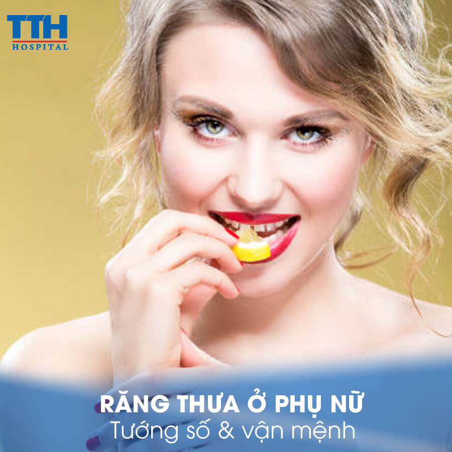 Răng thưa ở phụ nữ: Tướng số - vận mệnh