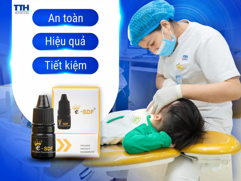 SILVER DIAMINE FLUORIDE (SDF) – GIẢI PHÁP HIỆU QUẢ GIÚP ĐIỀU TRỊ DỨT ĐIỂM SÂU RĂNG CHO TRẺ 