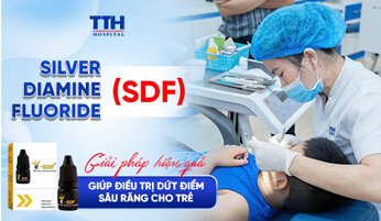SILVER DIAMINE FLUORIDE (SDF) – GIẢI PHÁP HIỆU QUẢ GIÚP ĐIỀU TRỊ DỨT ĐIỂM SÂU RĂNG CHO TRẺ 