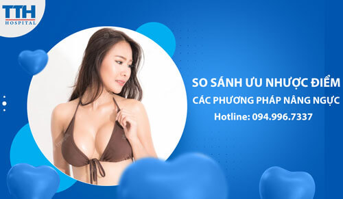 So sánh ưu nhược điểm của các phương pháp nâng ngực hiện đại