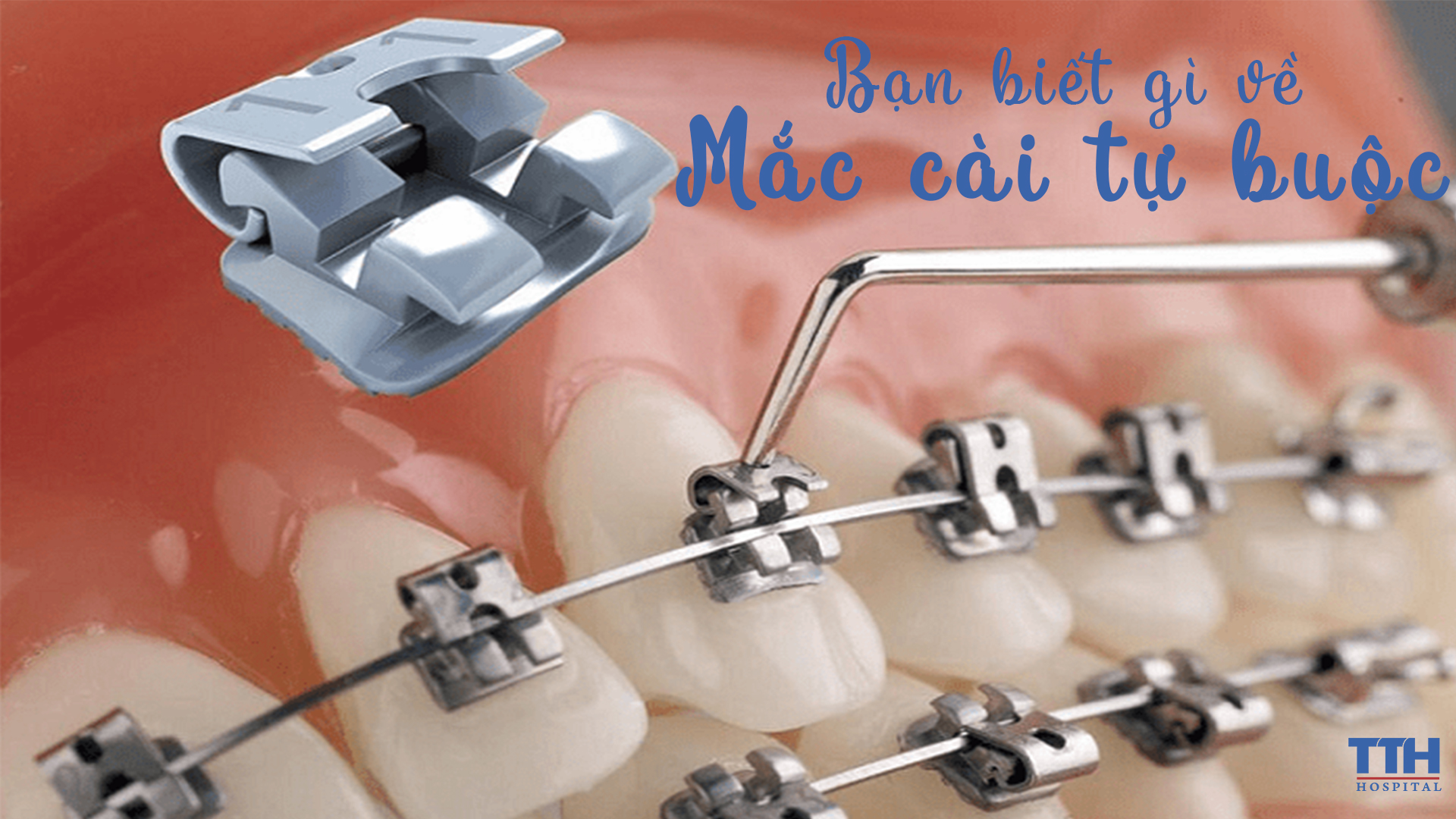 BẠN BIẾT GÌ VỀ MẮC CÀI THÔNG MINH