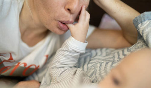 Trị nám an toàn cho bà mẹ đang cho con bú: Giải pháp toàn diện và hiệu quả