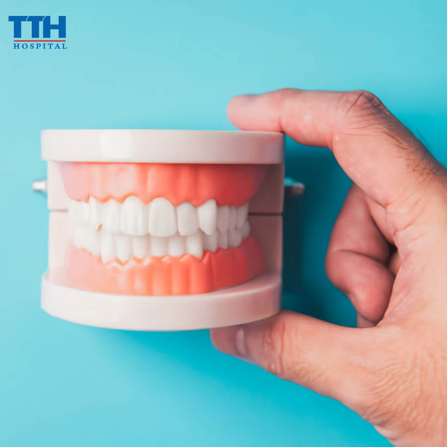 Trồng Răng Implant Và Sức Khỏe Xương Hàm: Những Điều Bạn Nên Biết