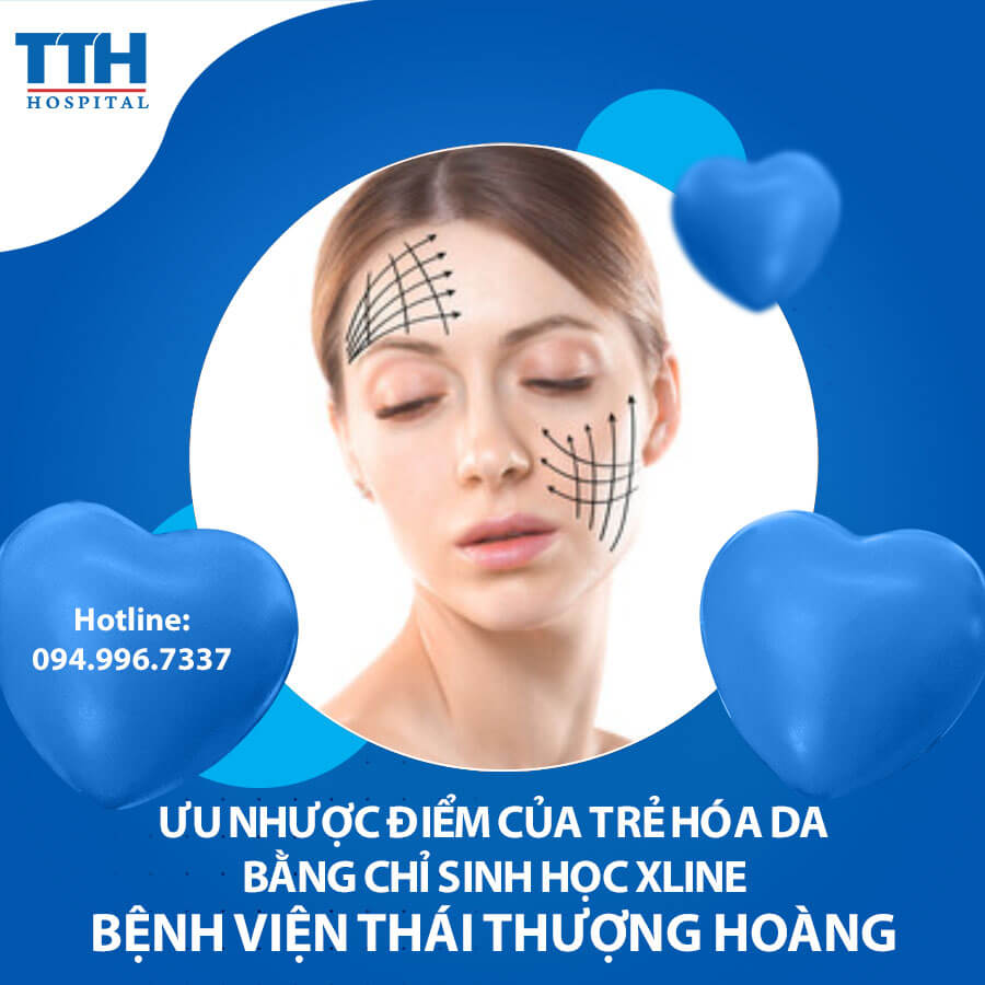Ưu nhược điểm của trẻ hóa da bằng chỉ sinh học Xline