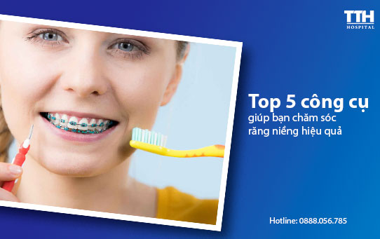Top 5 công cụ giúp bạn chăm sóc răng niềng hiệu quả